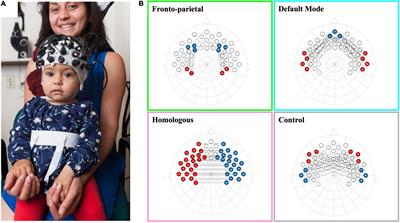 Examining the Role of Socioeconomic Status and Maternal Sensitivity in Predicting Functional Brain Network Connectivity in 5-Month-Old Infants